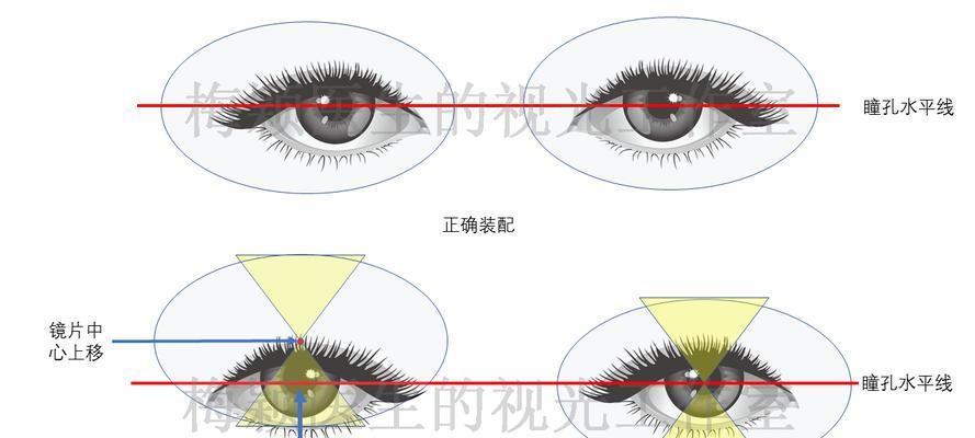 探究斜视的成因及其对视力的影响（深入了解以后天斜视的形成原因和视力损害情况）